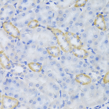Immunohistochemistry - MRPS30 Polyclonal Antibody 
