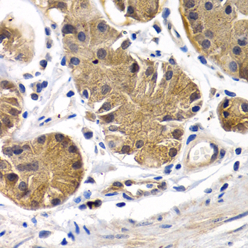 Immunohistochemistry - PTGIR Polyclonal Antibody 