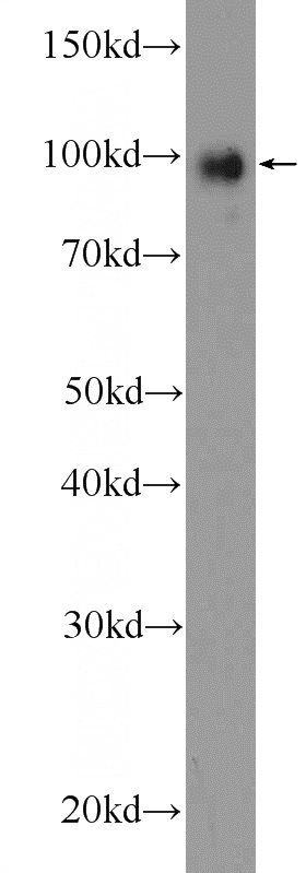 MCF-7 cells were subjected to SDS PAGE followed by western blot with Catalog No:116479(TTK Antibody) at dilution of 1:300