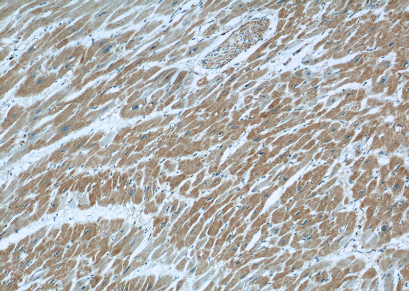 Immunohistochemical of paraffin-embedded human heart using Catalog No:112289(LNPEP antibody) at dilution of 1:50 (under 10x lens)