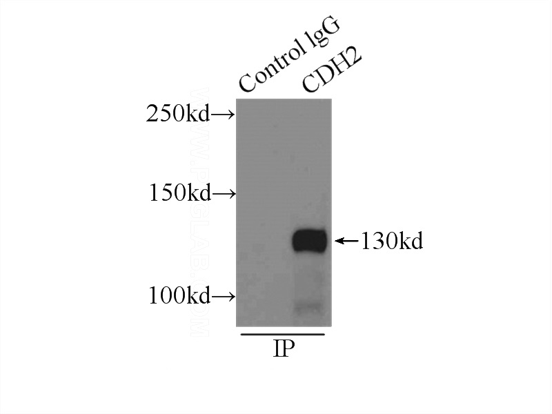 IP Result of anti-N-cadherin (IP:Catalog No:113024, 3ug; Detection:Catalog No:113024 1:1500) with mouse brain tissue lysate 7000ug.