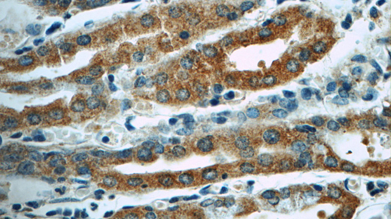 Immunohistochemistry of paraffin-embedded human stomach tissue slide using Catalog No:114458(RAB7A Antibody) at dilution of 1:50 (under 40x lens)