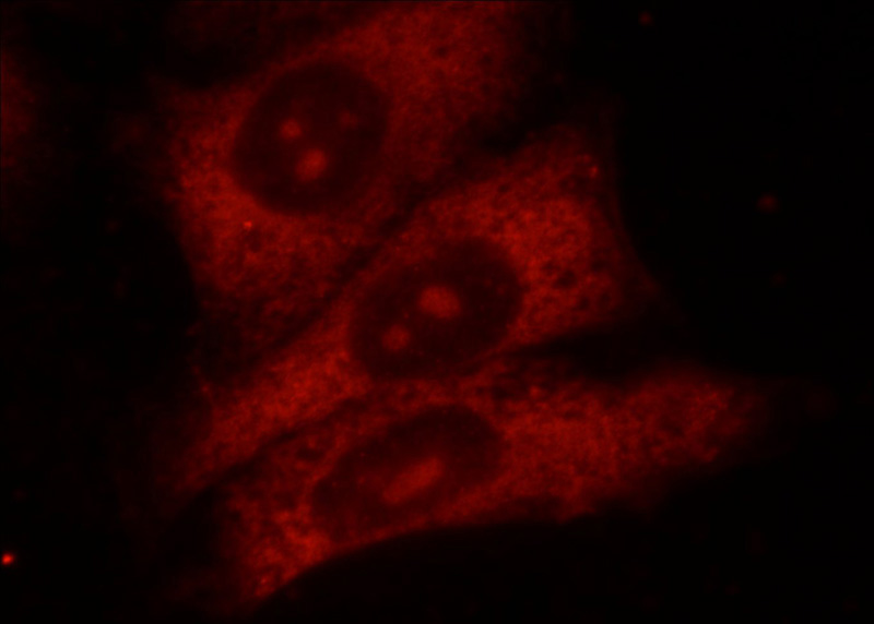 Immunofluorescent analysis of HeLa cells using Catalog No:111456(HPSE Antibody) at dilution of 1:25 and Rhodamine-Goat anti-Rabbit IgG