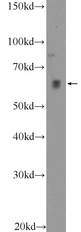 HeLa cells were subjected to SDS PAGE followed by western blot with Catalog No:112022(KDELC2 Antibody) at dilution of 1:600