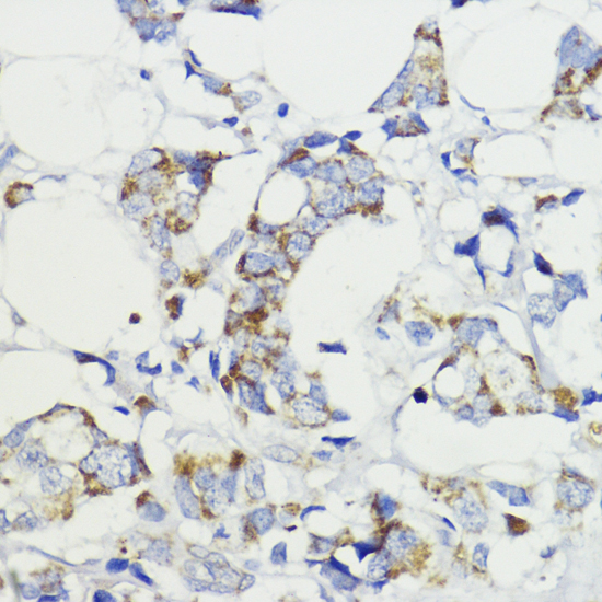 Immunohistochemistry - VEGFB Polyclonal Antibody 