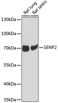 Western blot - SENP2 Polyclonal Antibody 