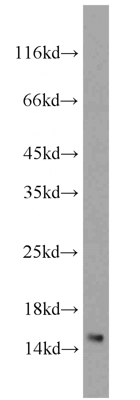 MCF7 cells were subjected to SDS PAGE followed by western blot with Catalog No:112349(LSM4 antibody) at dilution of 1:800