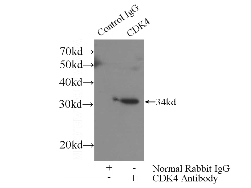 IP Result of anti-CDK4 (IP:Catalog No:109161, 3ug; Detection:Catalog No:109161 1:1000) with HeLa cells lysate 4000ug.