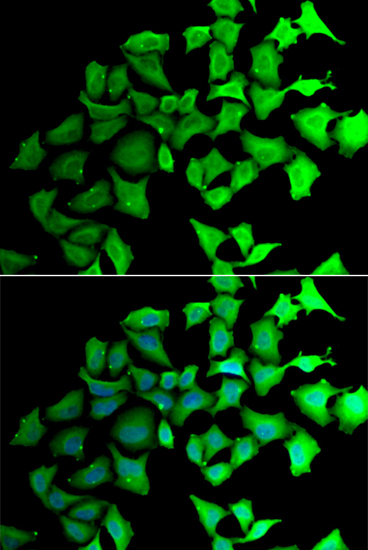 Immunofluorescence - TALDO1 Polyclonal Antibody 