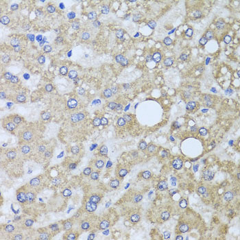 Immunohistochemistry - AARS2 Polyclonal Antibody 