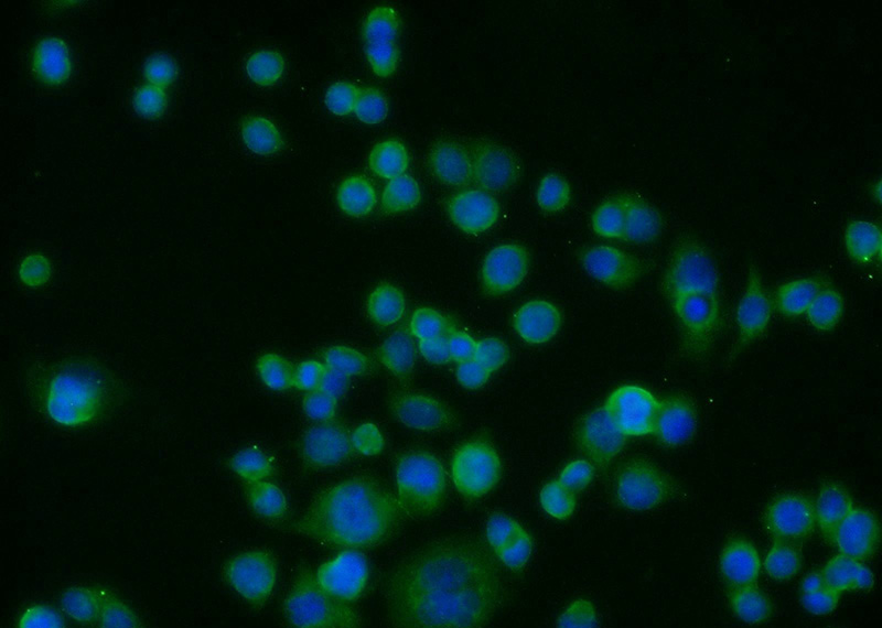 Immunofluorescent analysis of COLO 320 cells using Catalog No:110837(LGALS4,GAL4 Antibody) at dilution of 1:25 and Alexa Fluor 488-congugated AffiniPure Goat Anti-Rabbit IgG(H+L)