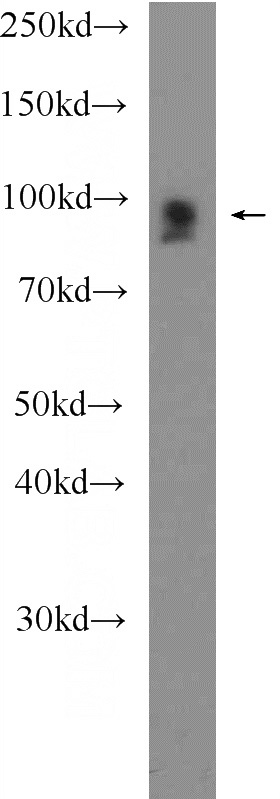 mouse heart tissue were subjected to SDS PAGE followed by western blot with Catalog No:110782(FSD2 Antibody) at dilution of 1:600
