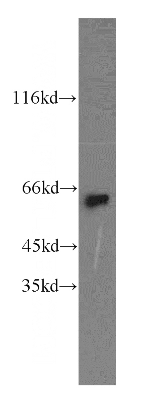 mouse brain tissue were subjected to SDS PAGE followed by western blot with Catalog No:113121(NEURL antibody) at dilution of 1:800