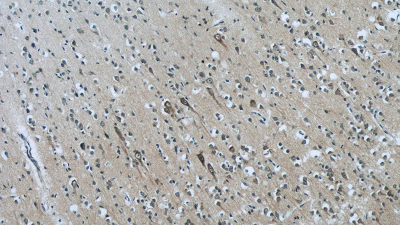 Immunohistochemistry of paraffin-embedded human brain tissue slide using Catalog No:107817(ABI2 Antibody) at dilution of 1:50 (under 10x lens)
