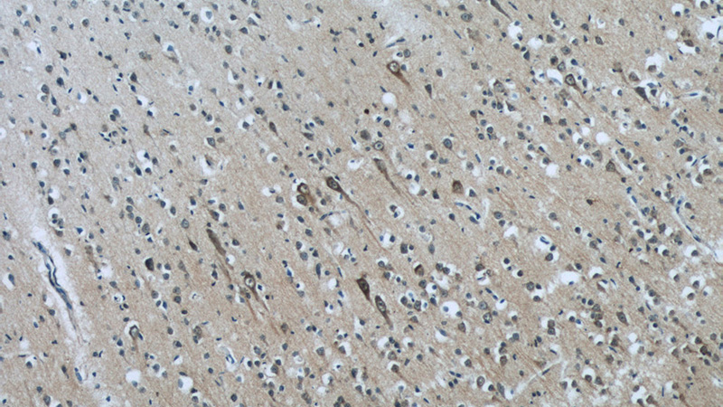 Immunohistochemistry of paraffin-embedded human brain tissue slide using Catalog No:107817(ABI2 Antibody) at dilution of 1:50 (under 10x lens)
