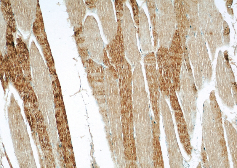 Immunohistochemical of paraffin-embedded human skeletal muscle using Catalog No:114361(PYGM-Specific antibody) at dilution of 1:50 (under 10x lens)