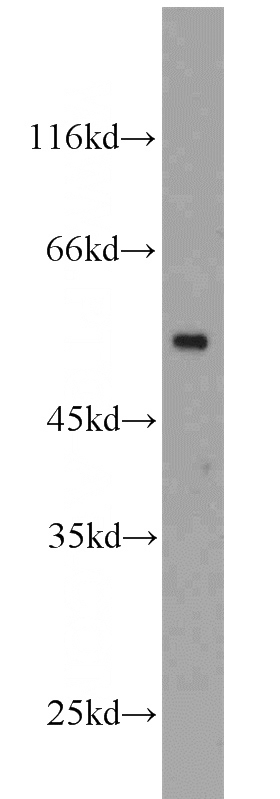 HeLa cells were subjected to SDS PAGE followed by western blot with Catalog No:117307(tubulin-beta antibody) at dilution of 1:1000