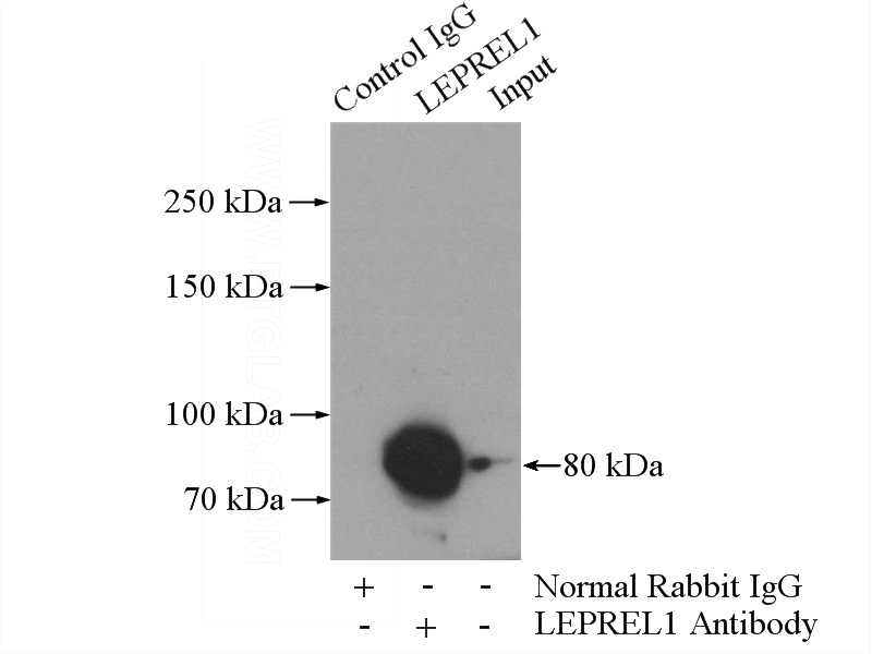 IP Result of anti-LEPREL1 (IP:Catalog No:112198, 4ug; Detection:Catalog No:112198 1:600) with mouse kidney tissue lysate 4000ug.