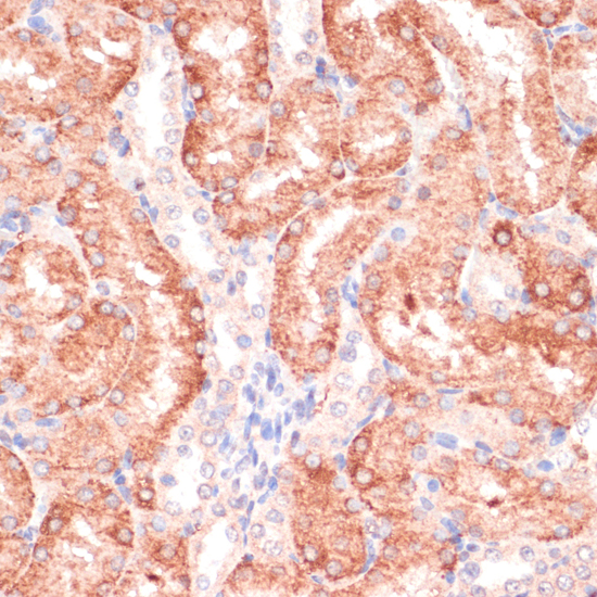 Immunohistochemistry - RPIA Polyclonal Antibody 