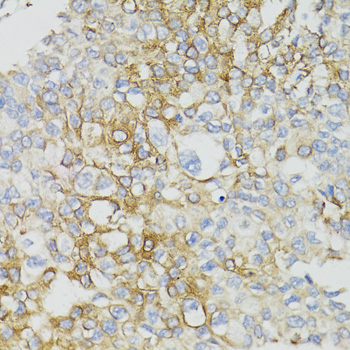 Immunohistochemistry - MT-ND5 Polyclonal Antibody 