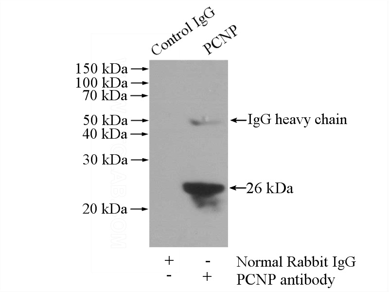 IP Result of anti-PCNP (IP:Catalog No:113745, 4ug; Detection:Catalog No:113745 1:600) with HepG2 cells lysate 1800ug.