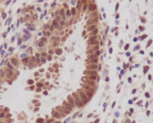 Immunohistochemical analysis of paraffin-embedded human uterus, using YAP1 Antibody.