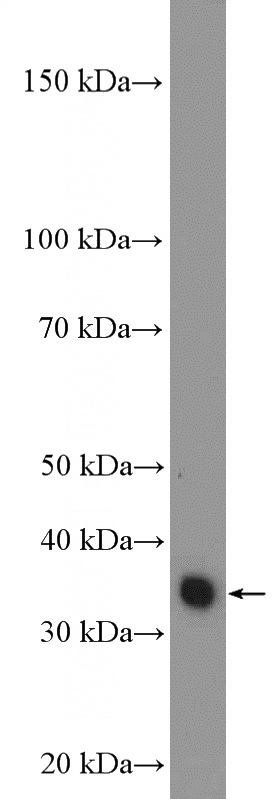 HeLa cells were subjected to SDS PAGE followed by western blot with Catalog No:111240(GTF3C6 Antibody) at dilution of 1:3000