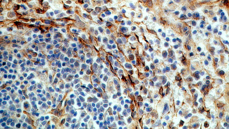 Immunohistochemical of paraffin-embedded human spleen using Catalog No:116105(TMEM173 antibody) at dilution of 1:100 (under 40x lens)