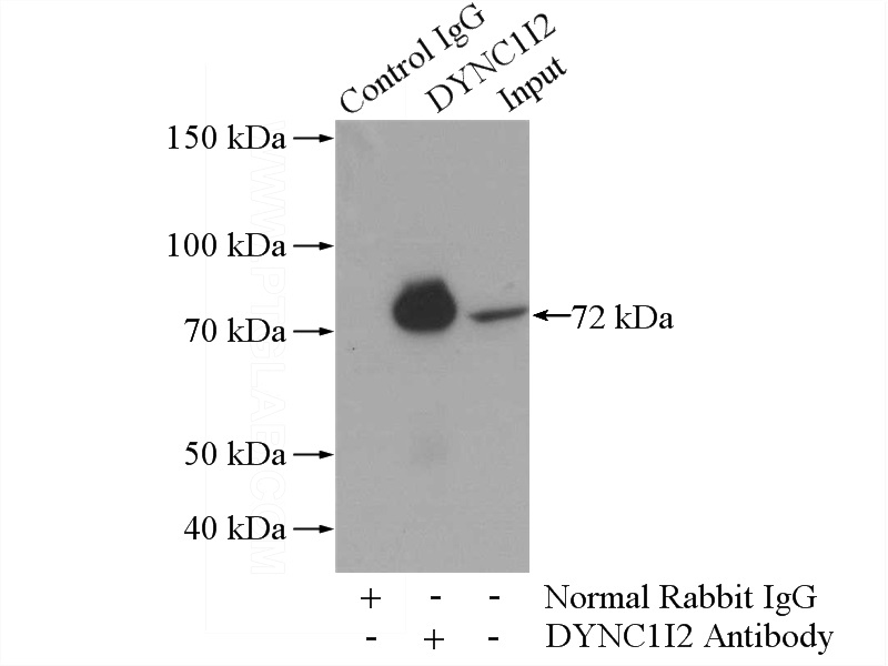 IP Result of anti-DYNC1I2 (IP:Catalog No:110136, 4ug; Detection:Catalog No:110136 1:500) with mouse testis tissue lysate 4000ug.
