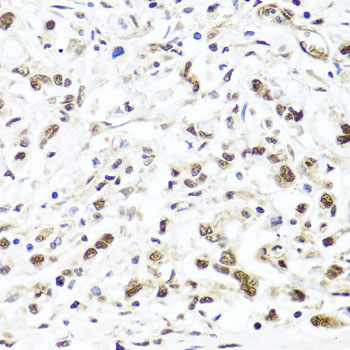 Immunohistochemistry - HIRA Polyclonal Antibody 