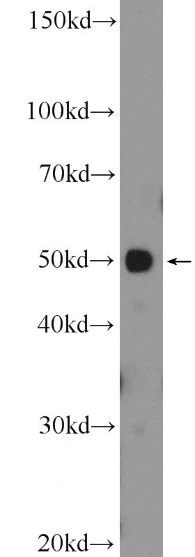 HepG2 cells were subjected to SDS PAGE followed by western blot with Catalog No:108140(API5 Antibody) at dilution of 1:300