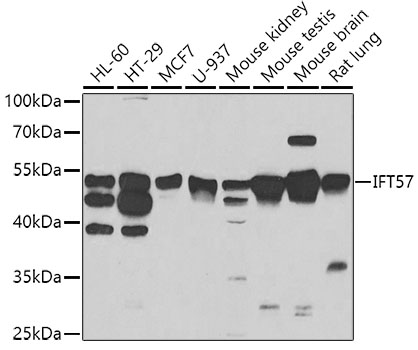 Western blot - IFT57 Polyclonal Antibody 
