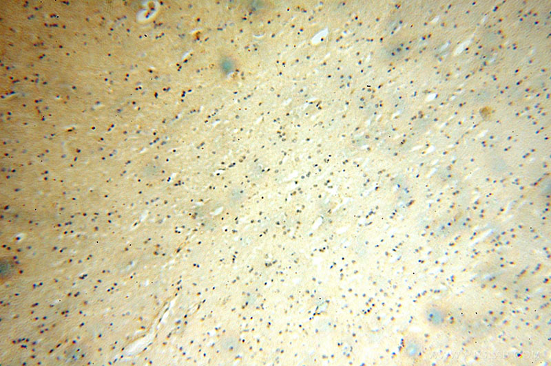 Immunohistochemical of paraffin-embedded human brain using Catalog No:112527(MFF antibody) at dilution of 1:100 (under 10x lens)
