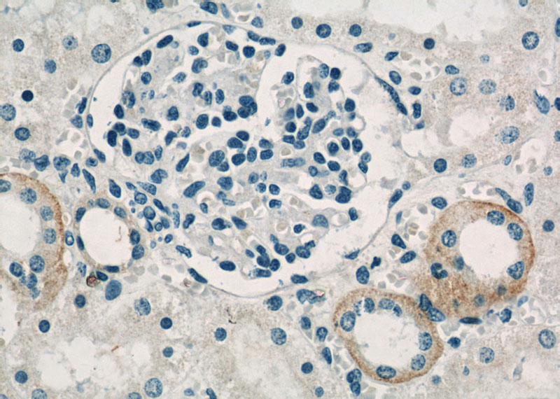 Immunohistochemistry of paraffin-embedded human kidney slide using Catalog No:113845(PRKACB Antibody) at dilution of 1:50