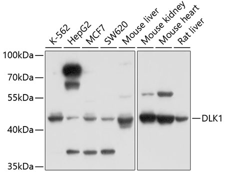 Western blot - DLK1 Polyclonal Antibody 