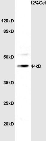 Fig1: Sample: Brain (Rat) Lysate at 40 ug; Primary: Anti-TBX1 at 1/300 dilution; Secondary: HRP conjugated Goat-Anti-rabbit IgG (bs-0295G-HRP) at 1/5000 dilution; Predicted band size: 43 kD; Observed band size: 44 kD