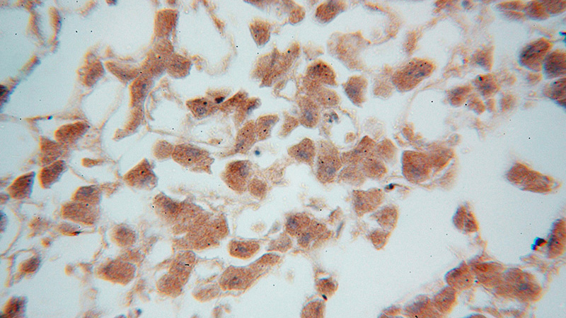 Immunohistochemical of paraffin-embedded human liver using Catalog No:113254(NMRAL1 antibody) at dilution of 1:50 (under 40x lens)
