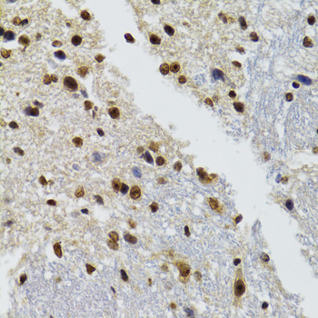 Immunohistochemistry - BAZ1B Polyclonal Antibody 