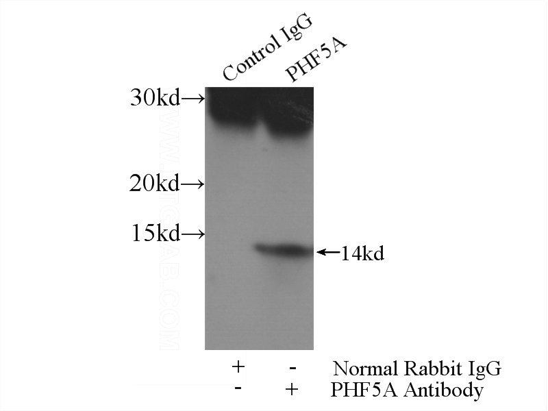 IP Result of anti-INI-1 (IP:Catalog No:113814, 3ug; Detection:Catalog No:113814 1:500) with HeLa cells lysate 4000ug.