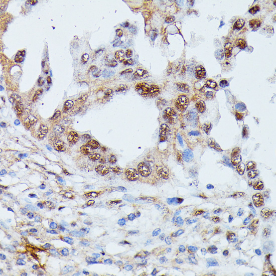 Immunohistochemistry - IGHMBP2 Polyclonal Antibody 