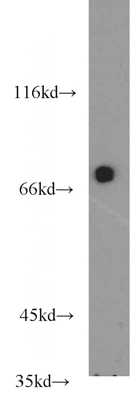Jurkat cells were subjected to SDS PAGE followed by western blot with Catalog No:115411(LCP2 antibody) at dilution of 1:1000