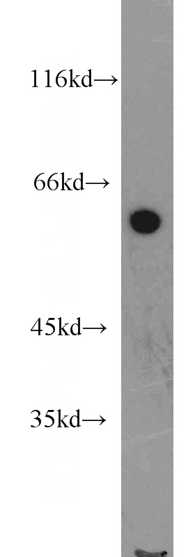 HepG2 cells were subjected to SDS PAGE followed by western blot with Catalog No:111620(IFIT3 antibody) at dilution of 1:800