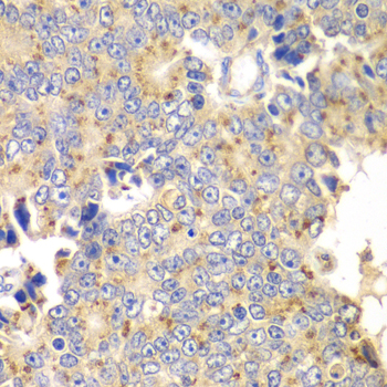 Immunohistochemistry - PICK1 Polyclonal Antibody 