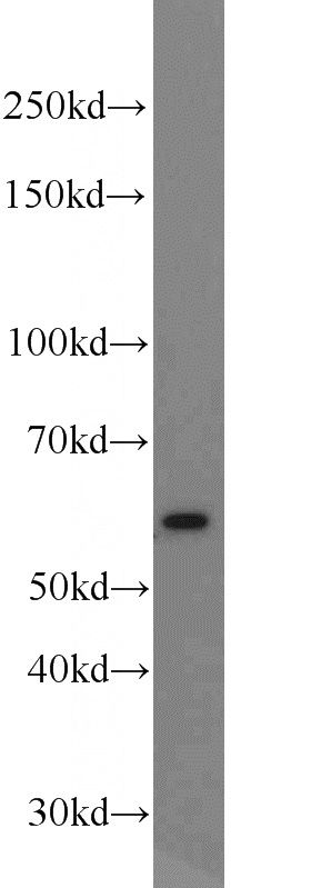 HeLa cells were subjected to SDS PAGE followed by western blot with Catalog No:112746(MPO antibody) at dilution of 1:600