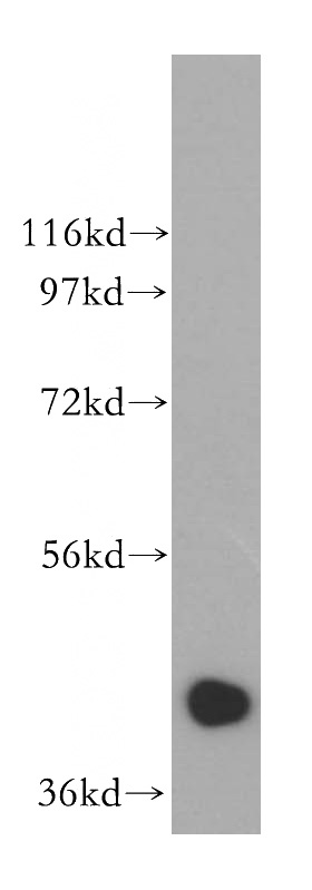 HeLa cells were subjected to SDS PAGE followed by western blot with Catalog No:113022(NANS antibody) at dilution of 1:500