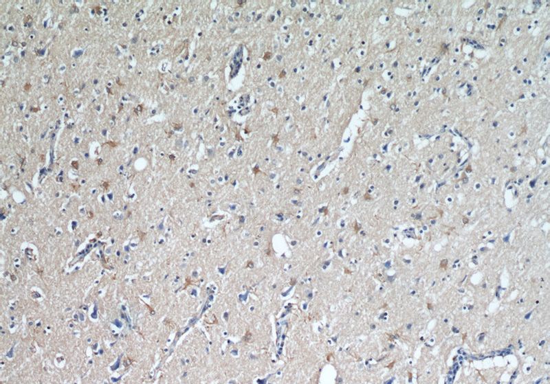 Immunohistochemical of paraffin-embedded human brain using Catalog No:116746(SLC17A7 antibody) at dilution of 1:50 (under 10x lens)
