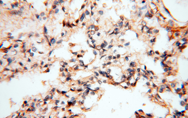 Immunohistochemical of paraffin-embedded human lung using Catalog No:113836(PITPNA antibody) at dilution of 1:100 (under 40x lens)