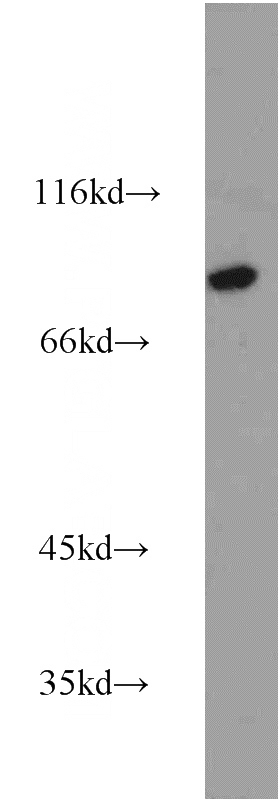 human heart tissue were subjected to SDS PAGE followed by western blot with Catalog No:108837(CAPN7 antibody) at dilution of 1:1000