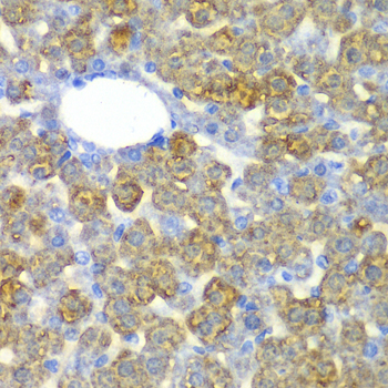 Immunohistochemistry - FAH Polyclonal Antibody 