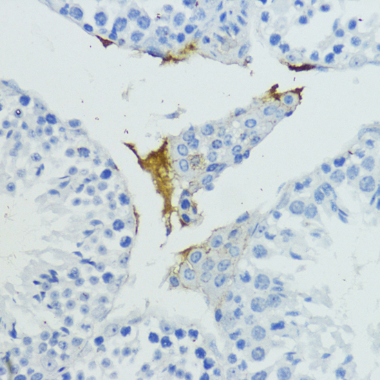 Immunohistochemistry - KLKB1 Polyclonal Antibody 